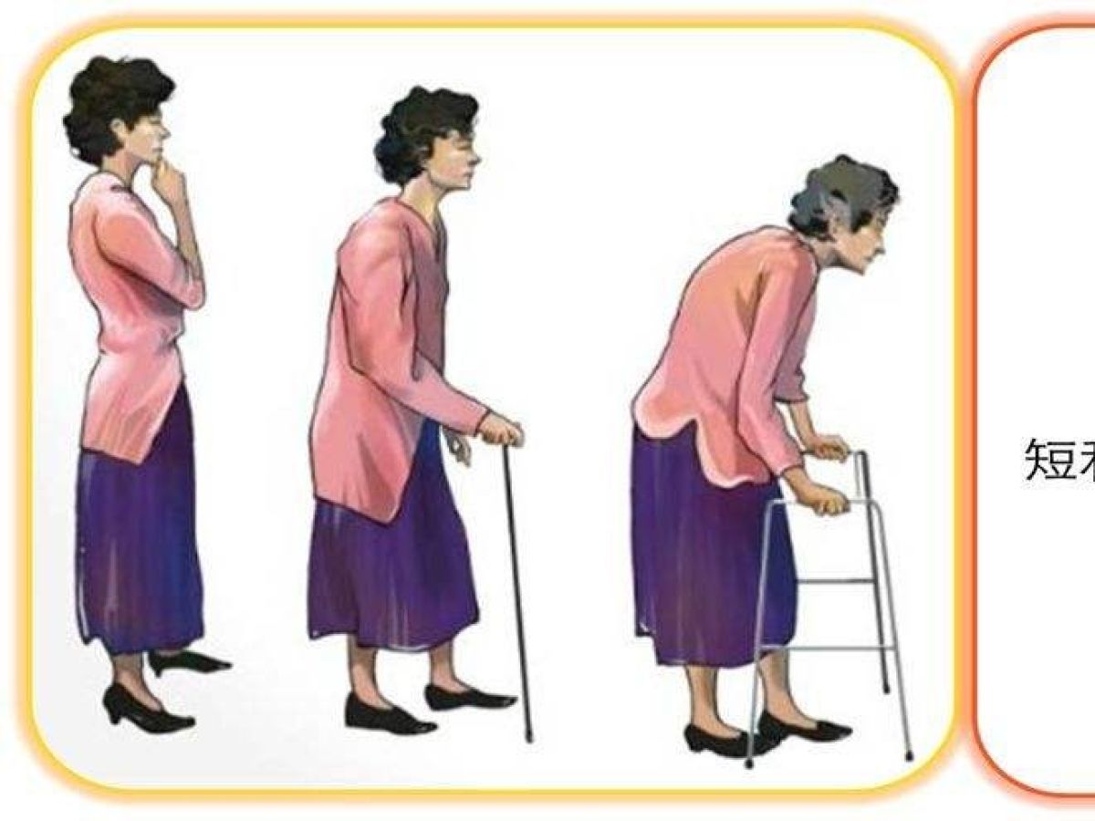 呵护关节  让我们行动起来